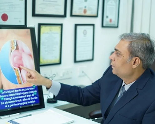 Hernia recommendation